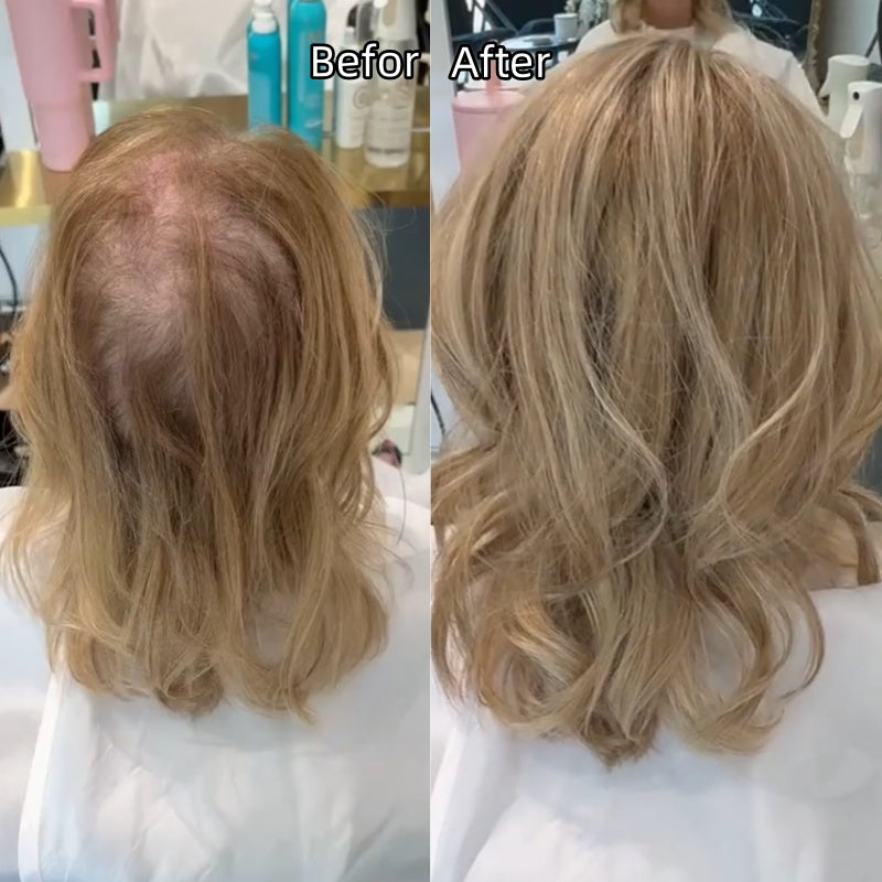 🌷2026 New Lightweight & Breathable Wavy Hair Topper